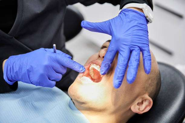 Best Emergency Root Canal Treatment in Porcupine, SD